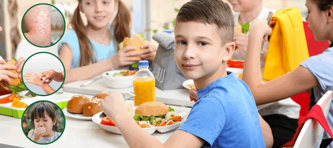 Food Allergies In Kids
