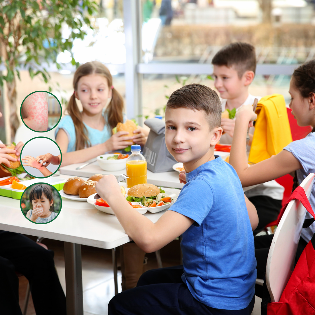 Food Allergies In Kids